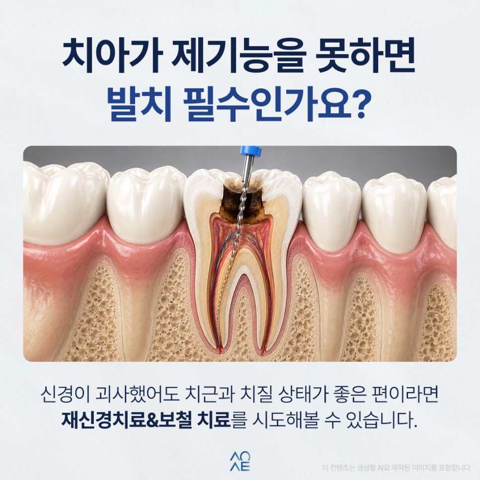20대 임플란트 해도 괜찮을까요? 아직 나이도 초반인데 어쩌죠 관련 이미지 2