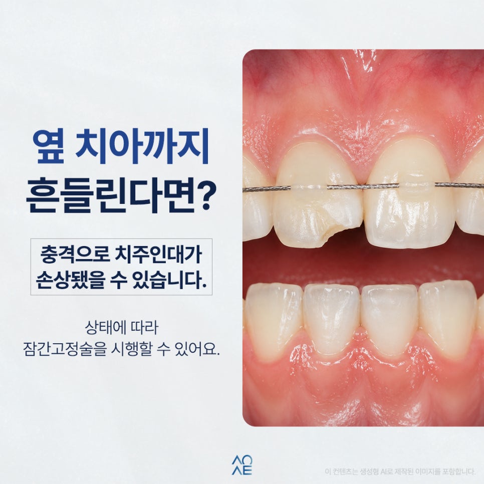 앞니파절 후 신경치료 크라운 잠간고정술 무조건 필요한가요? 관련 이미지 5