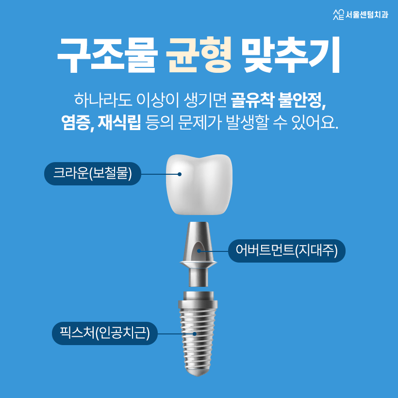 임플란트 사용기간 몇 년인지 궁금해요 오래 쓰는 노하우는? 관련 이미지 2