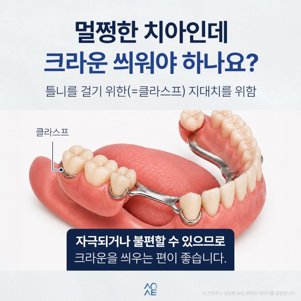 어금니 부분틀니 비용이 높다고요? 이유와 크라운 필요성 알려주세요 관련 이미지 3