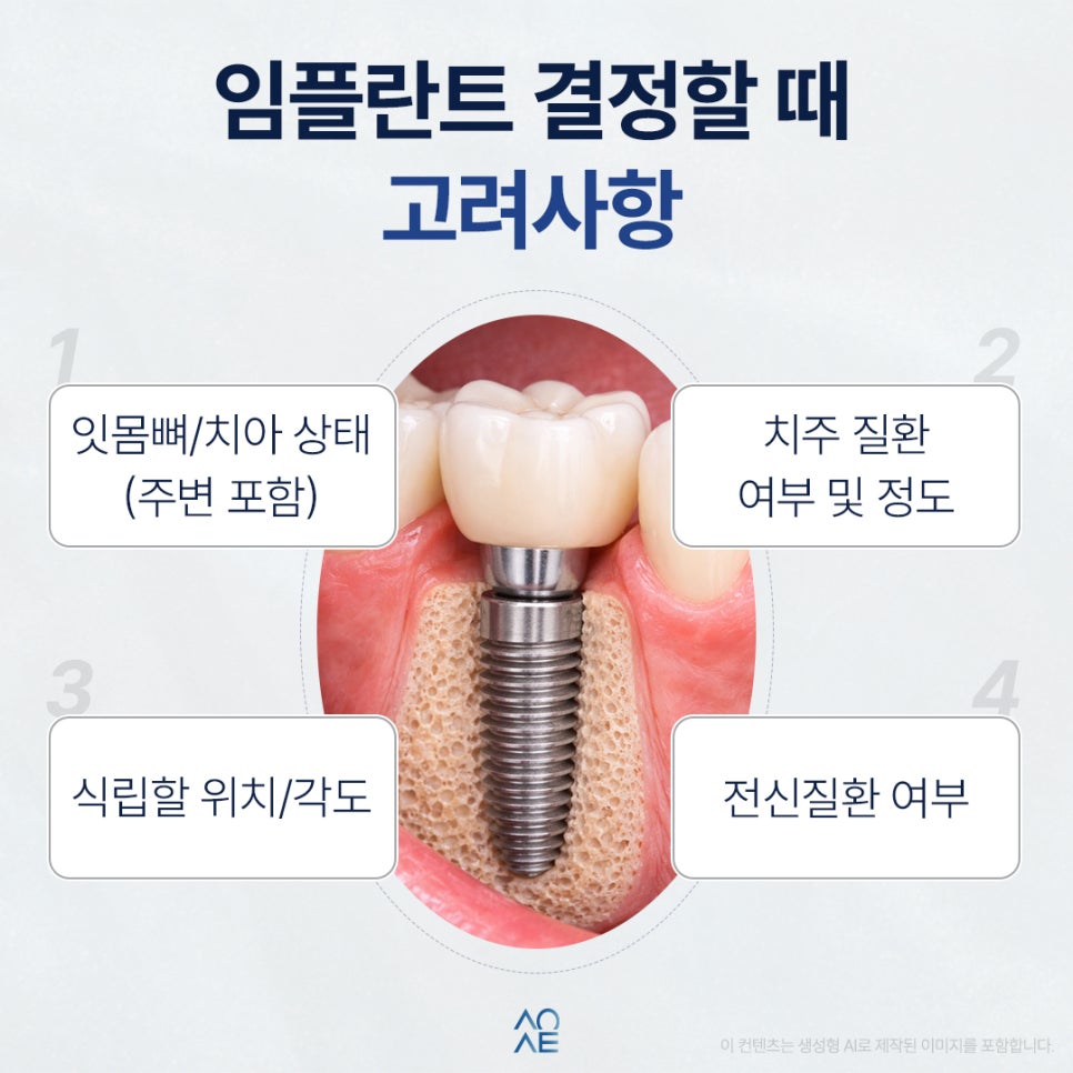 임플란트 치주염 옆자리에 권유받았다면 필요한지 판단할 것 관련 이미지 6