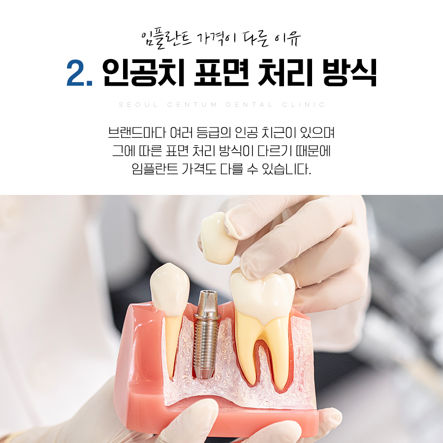 임플란트1개가격 어느 치과든 상관없이 천차만별인 이유 6가지 관련 이미지 6