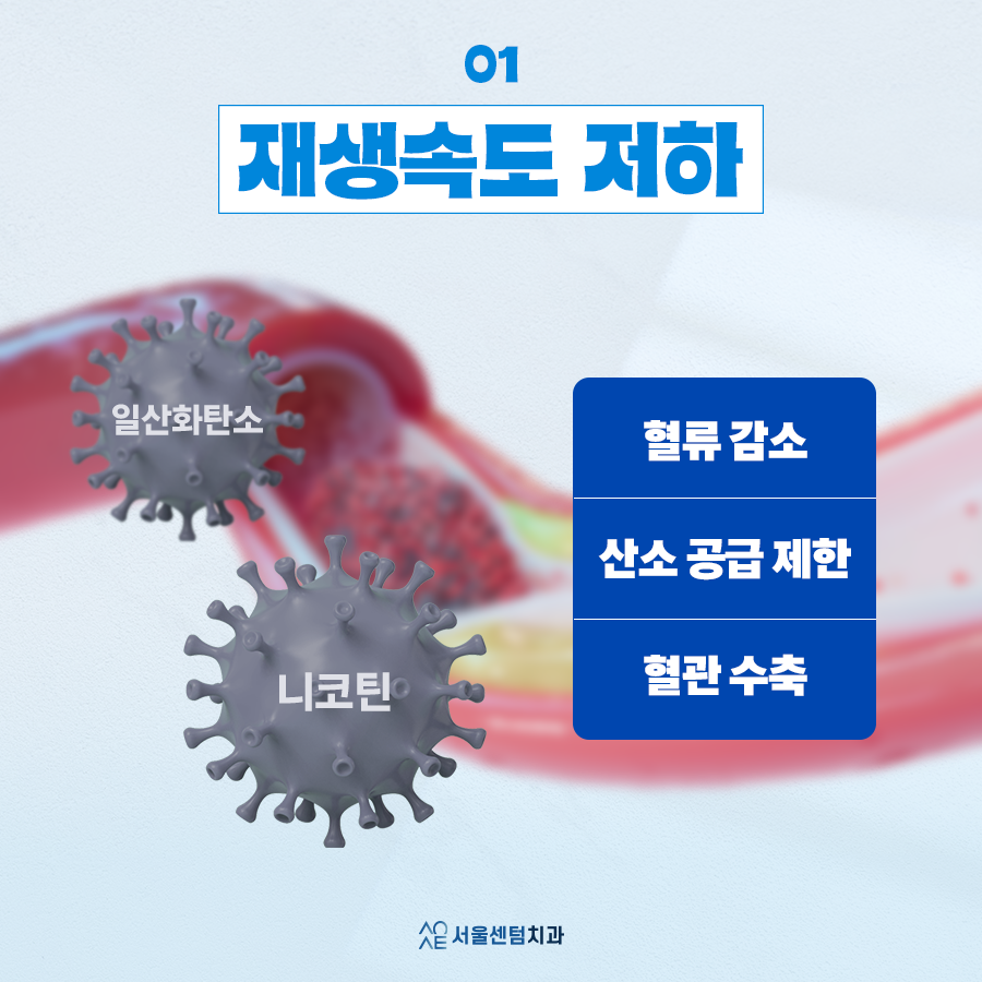 임플란트당일흡연 굳이 문제 생길 일 있을까요 하다가 큰일납니다 관련 이미지 2