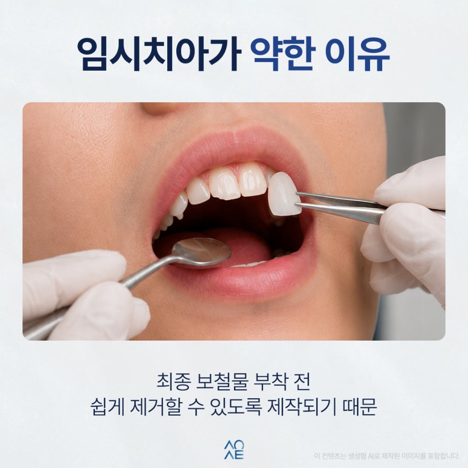 Can Laminate Veneers’ Temporary Teeth Break Frequently? Do I Need to Visit the Dentist Every Time? image 2