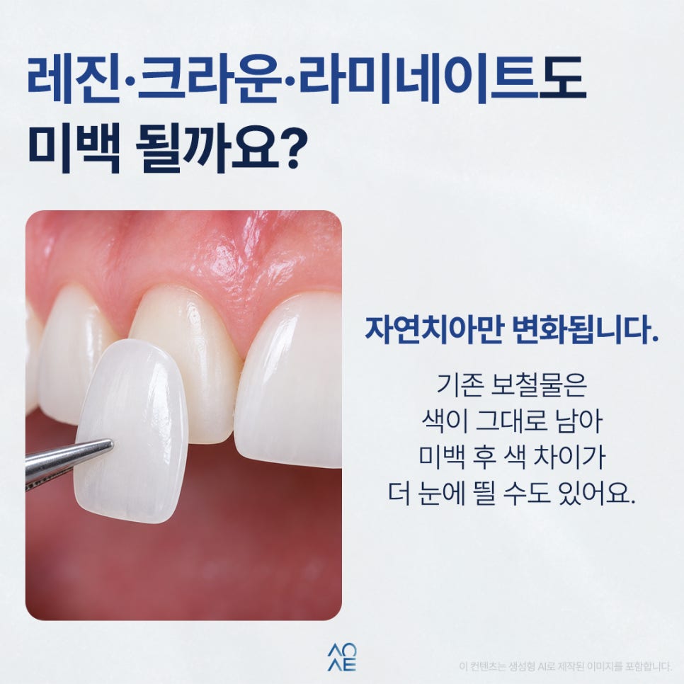 셀프 치아미백 로드샵 제품 효과 있나요? 미백 패치와 치약 차이 알아보기 관련 이미지 6