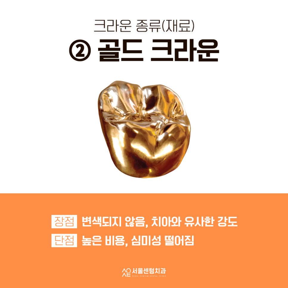 치과 크라운 종류 선택 쉽도록 설명할게요 관련 이미지 4