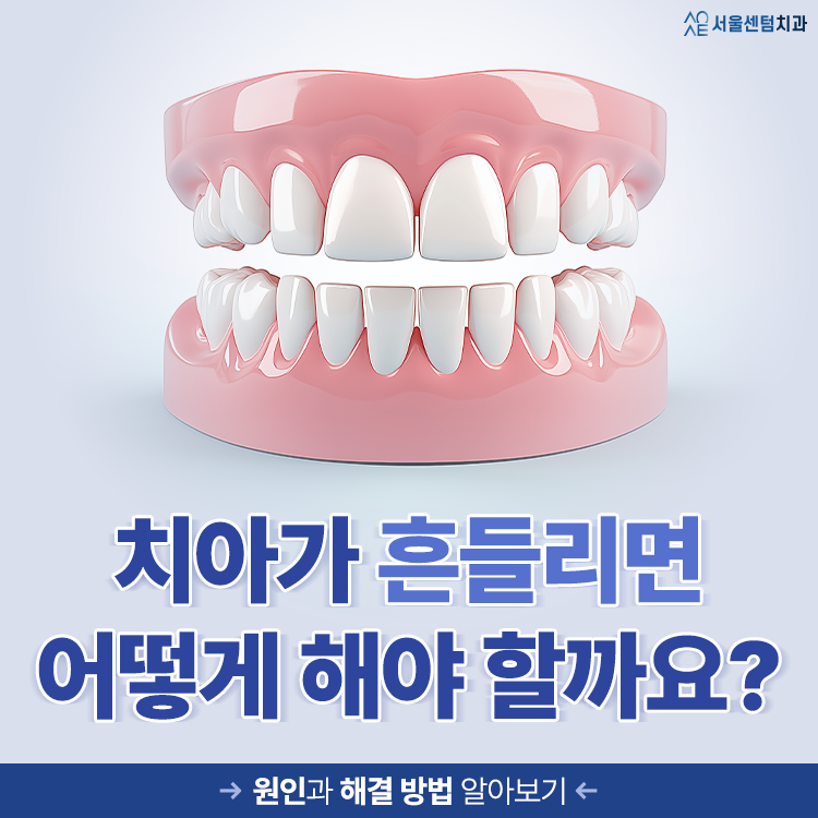 흔들리는 치아 가만히 두지 말고 즉각 치료받아야 하는 경우는? 관련 이미지 1
