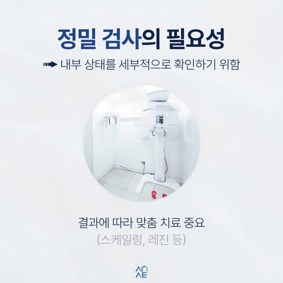 치아 검은점 발견했다면 충치인지 다른 문제인지 구분 방법 관련 이미지 5