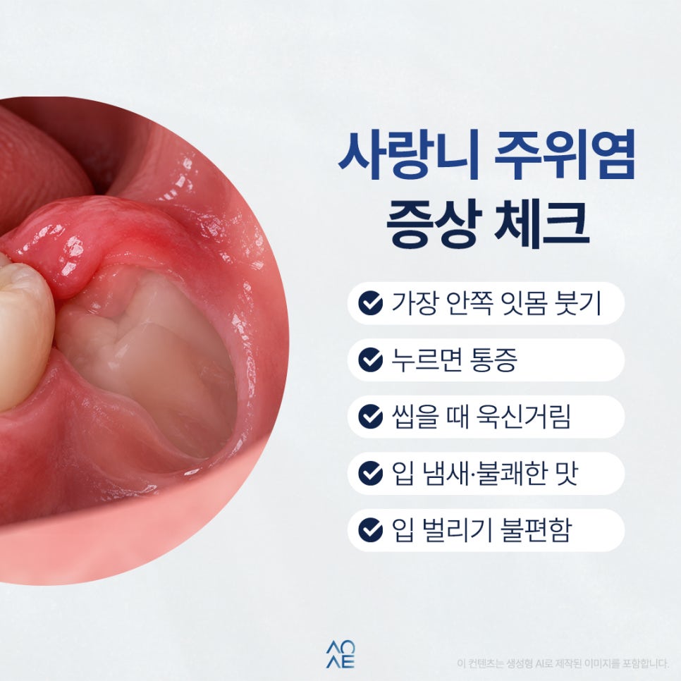 매복사랑니 통증 주위염 때문에 그럴 수도 있을까요? 관련 이미지 3