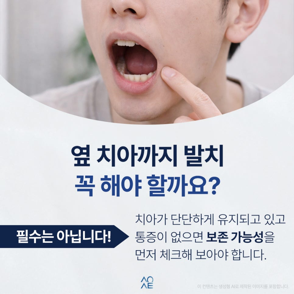 임플란트 치주염 옆자리에 권유받았다면 필요한지 판단할 것 관련 이미지 3