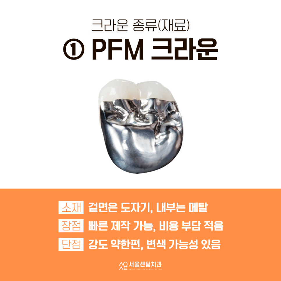 치과 크라운 종류 선택 쉽도록 설명할게요 관련 이미지 3
