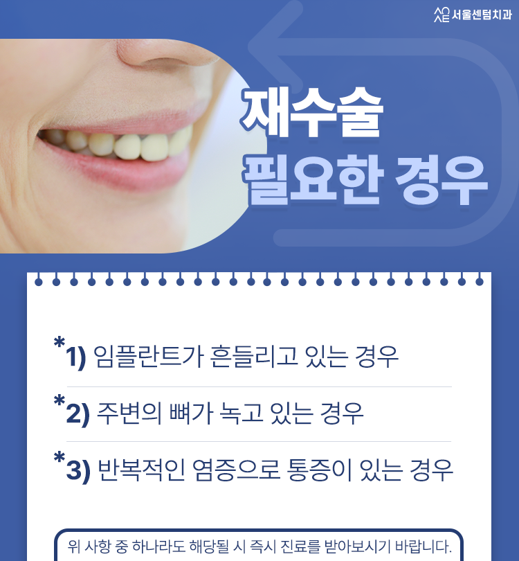 임플란트 재수술 실패가 아니라 처음 선택의 문제일 수 있습니다 관련 이미지 5