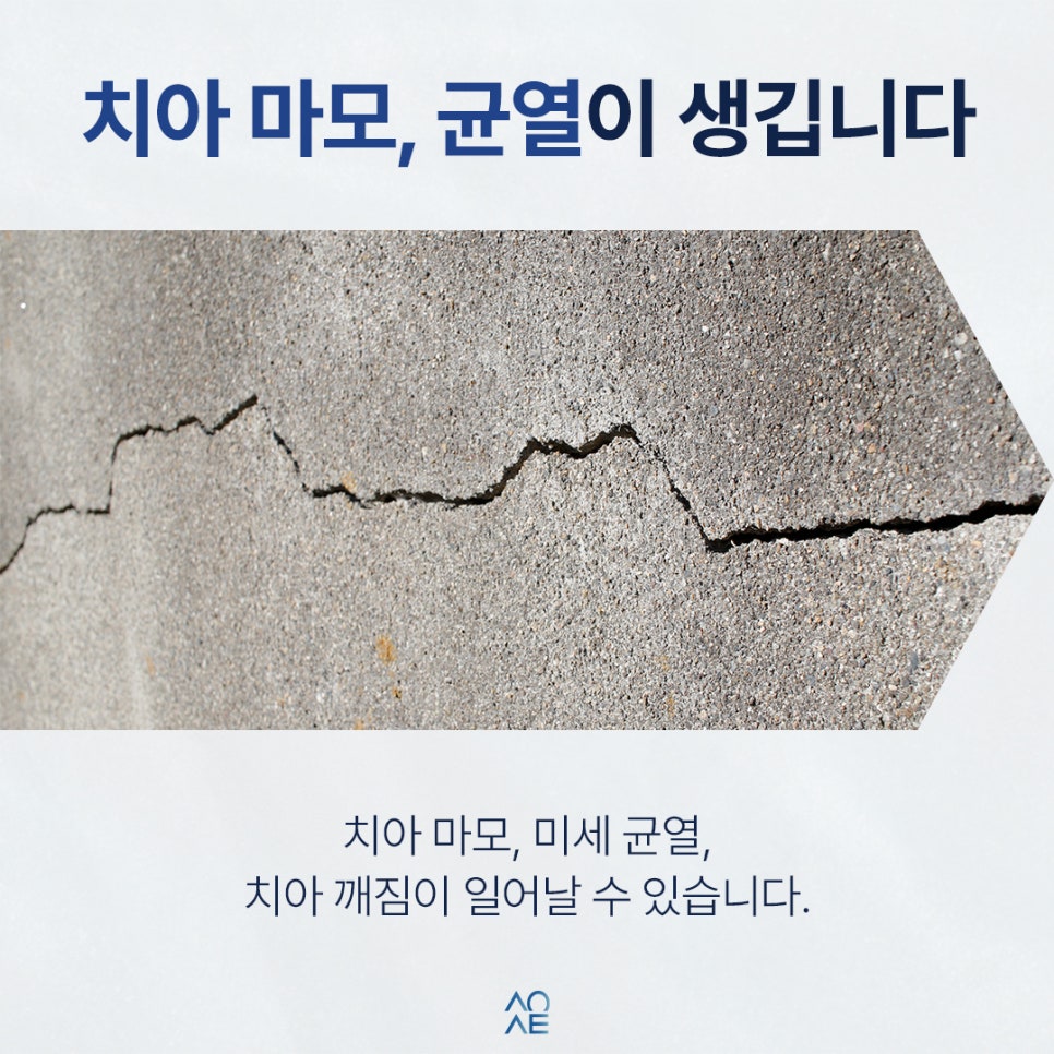 한쪽으로만 씹으면 생기는 일 나중에 임플란트까지 갈 수 있습니다 관련 이미지 3