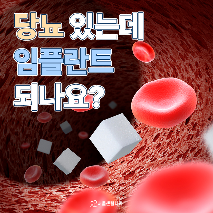 당뇨임플란트 가능 여부 관련 고찰 고혈압 동반 환자는 어떻게 관련 이미지 1