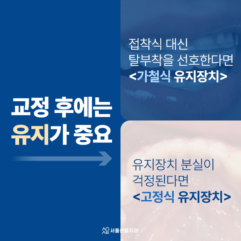 성인 치아교정 기간 평균과 단축하려면 어떻게 해야 할까 관련 이미지 6