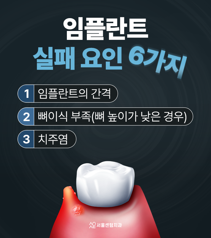 임플란트 식립 실패 하기 전 알아야할 1년후 원인과 대처법 관련 이미지 2