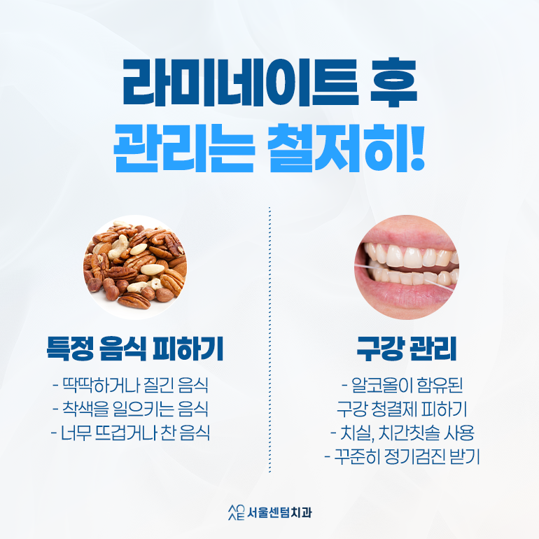 라미네이트 치과 이런 점을 보고 결정하셔야 합니다. 관련 이미지 10