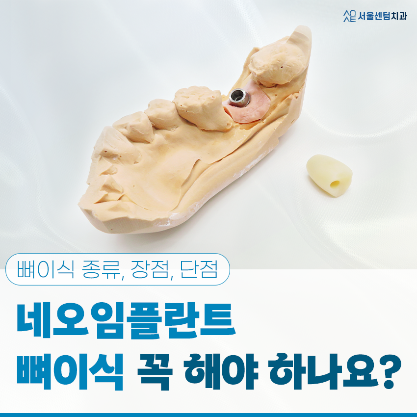 네오임플란트 뼈이식 꼭 해야할까?종류 장점 단점 관련 이미지 1