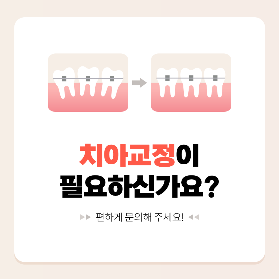 치아교정장치 종류 하나하나 알려드려요 관련 이미지 6
