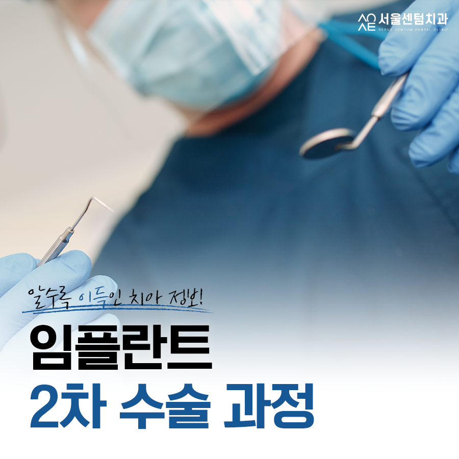 임플란트2차수술과정 언제 필요한지 핵심만 짚어보기 관련 이미지 3