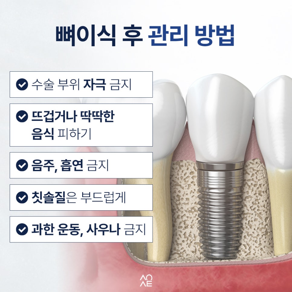 임플란트 뼈이식 꼭 해야할까요? 필요한 경우 관리 방법 정리본 관련 이미지 6