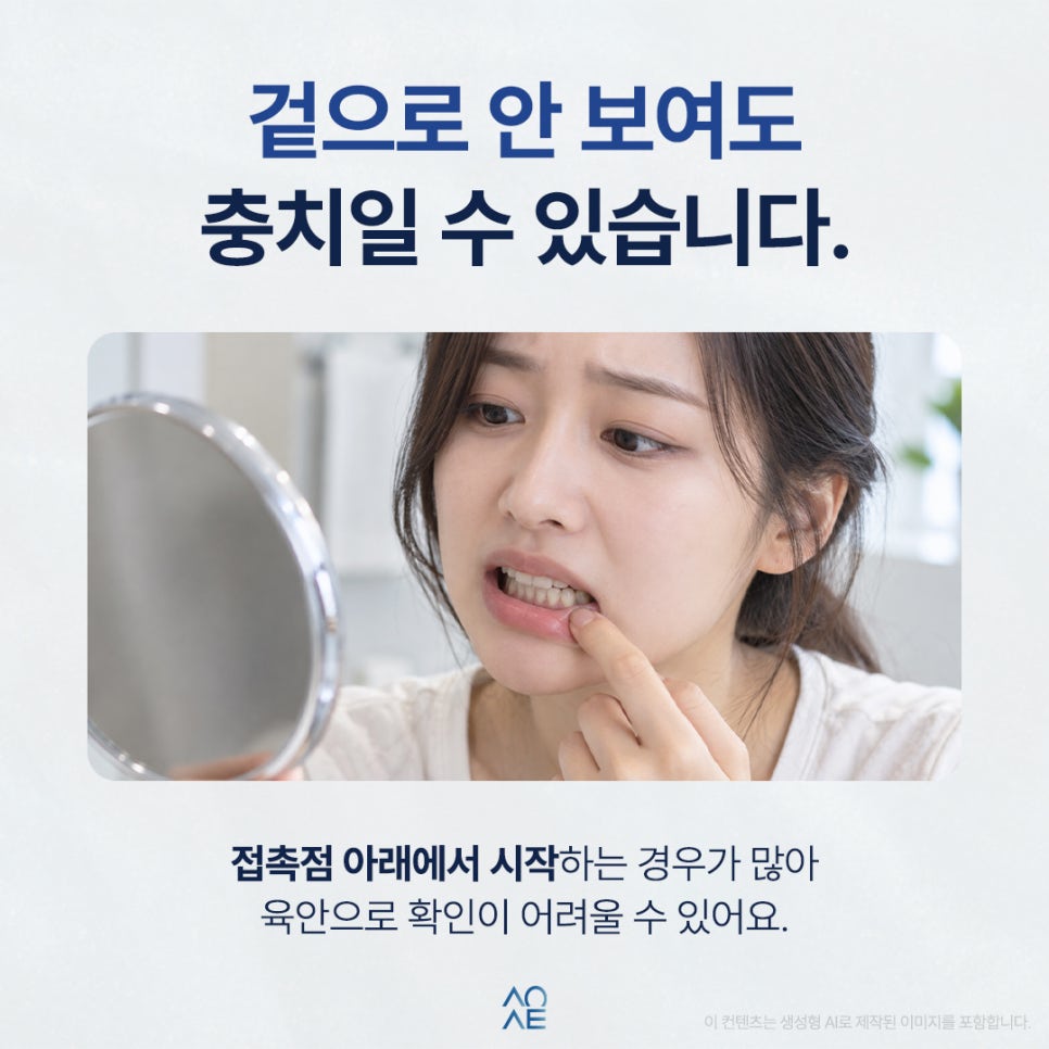 치아 사이 충치 옆까지 옮겨질 수 있나요? 관련 이미지 3