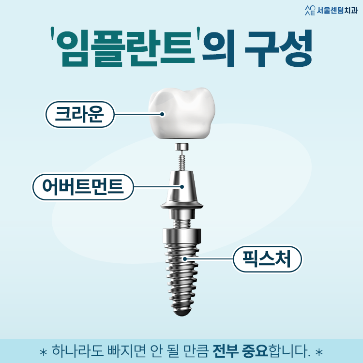 임플란트 구조 하나하나 뜯어보면 알 수 있는 원리 관련 이미지 2