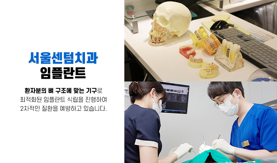 상악 전체임플란트 혹시 나도 대상자일까? 관련 이미지 9