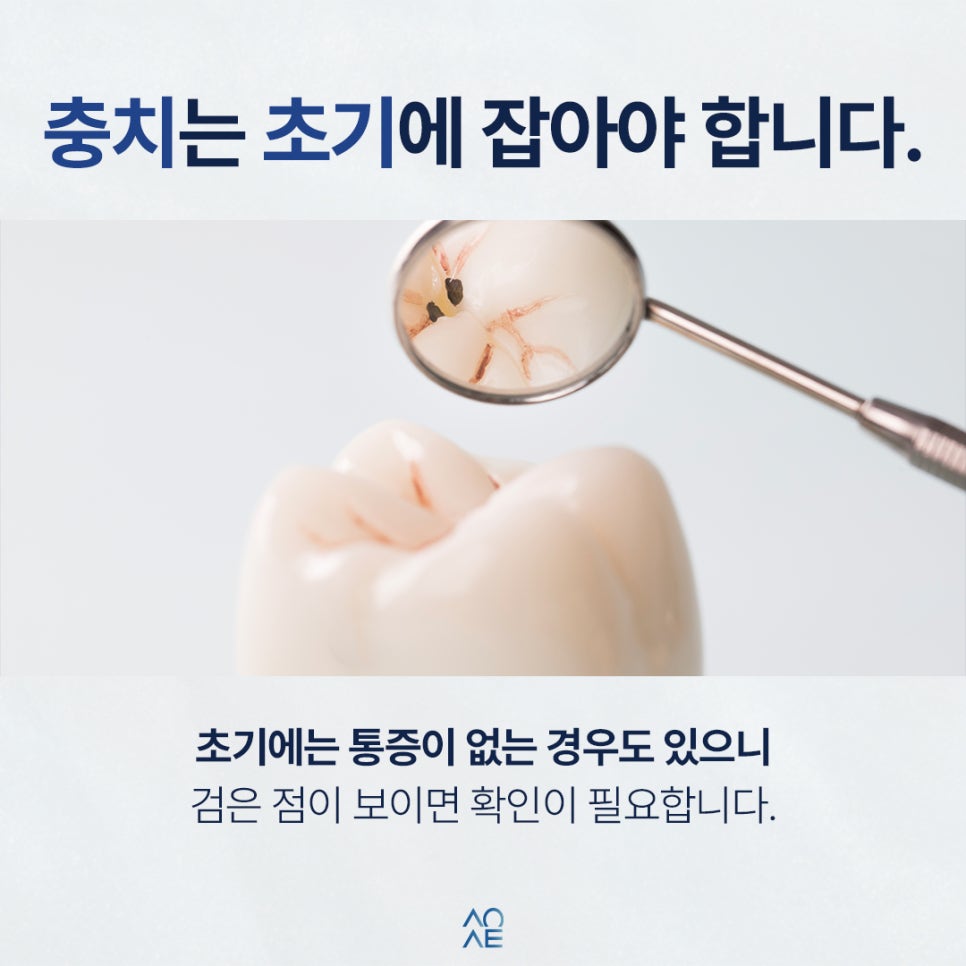 치아 검은점 발견했다면 충치인지 다른 문제인지 구분 방법 관련 이미지 4