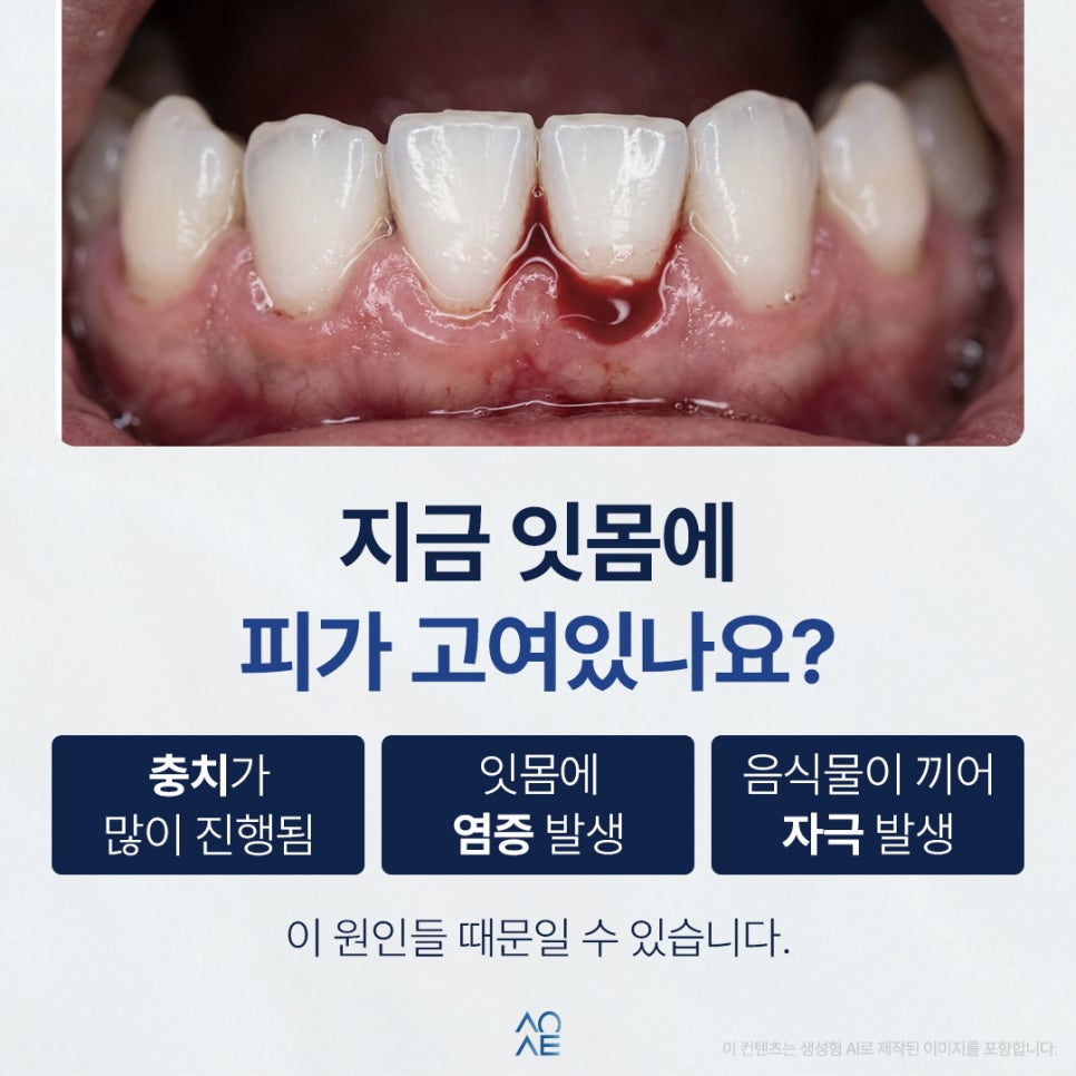 What Is the Treatment If a Permanent Tooth Is Missing Due to Congenital Tooth Absence? What About Teenagers? image 3