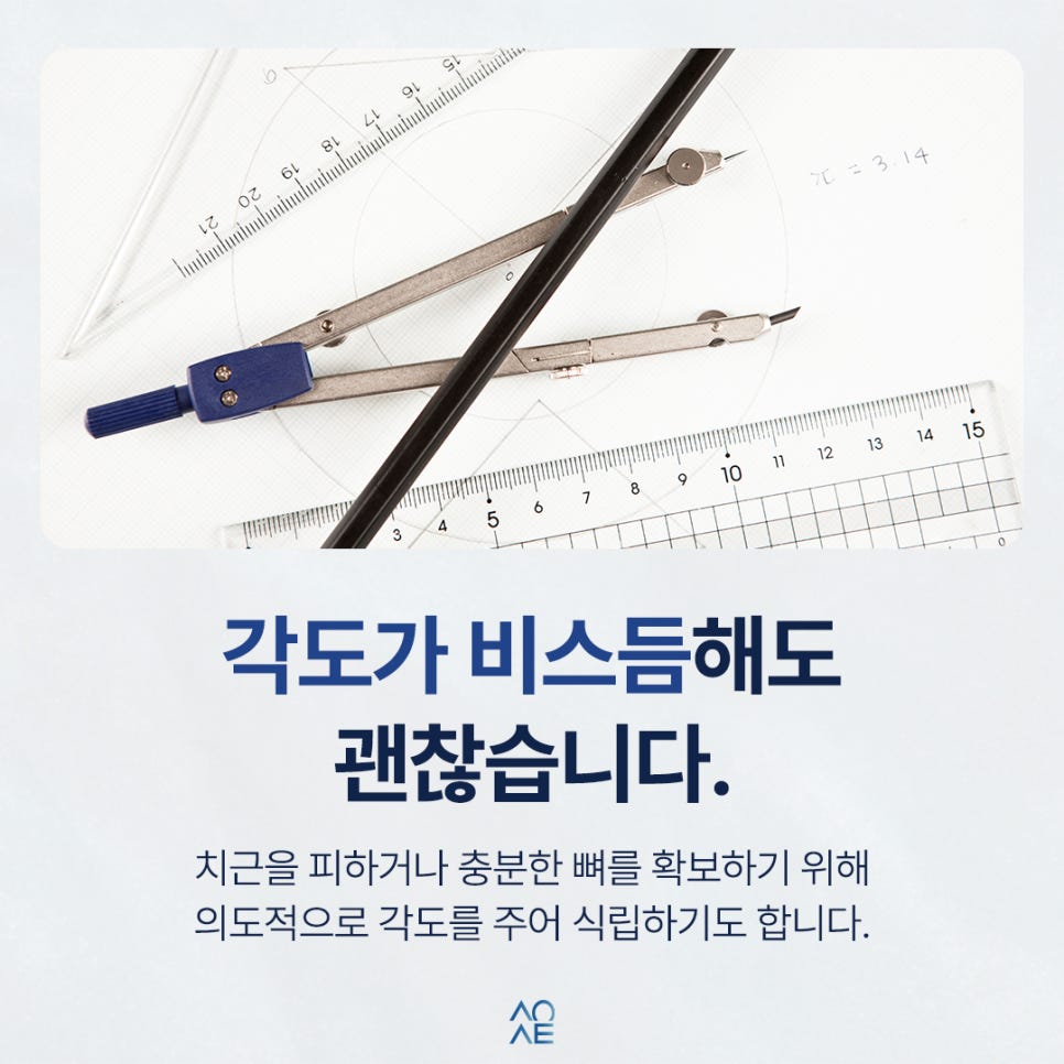 교정 미니스크류 풀리는 것 같은데 그대로 내버려둬도 되나요? 관련 이미지 4