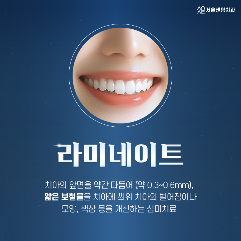 강남 라미네이트 치과 치아삭제 최소화 관련 이미지 3