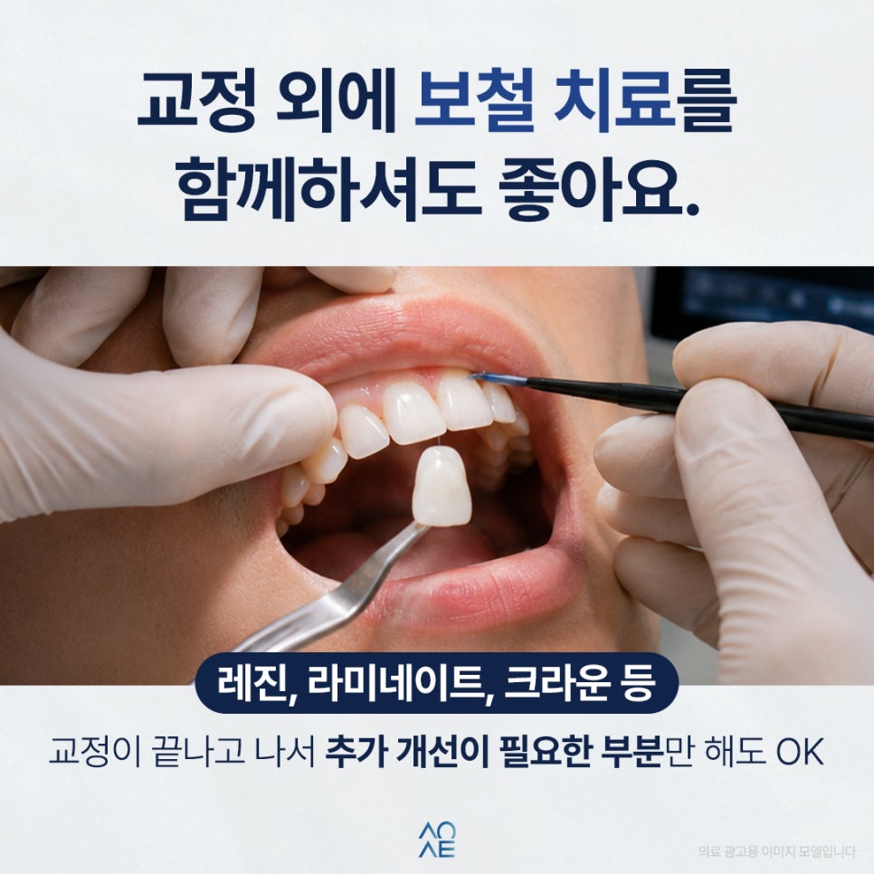 왜소치 교정 치아 기울어진 느낌 개선 가능? 라미네이트도 필요한가요 관련 이미지 5