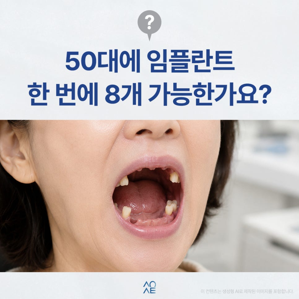 Is It Possible to Have 8 Implants in Your 50s? image 1