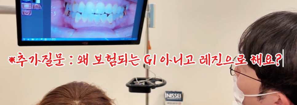 치아패임 이대로 두어도 괜찮을까요 치경부마모증 레진치료 관련 이미지 10
