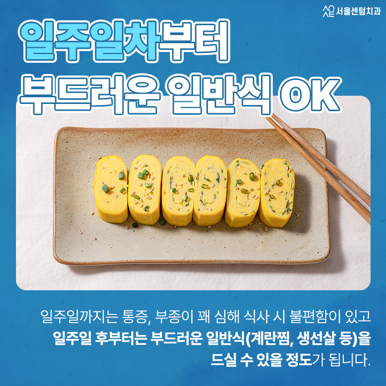 임플란트하고 통증 기간 언제까지? 무조건 참는 게 답일까 관련 이미지 3