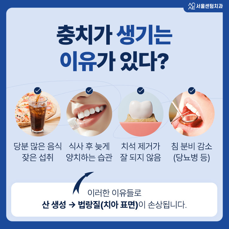 충치 초기 미세한 변화 증상이 점차 불어날 수 있는 시기 관련 이미지 2