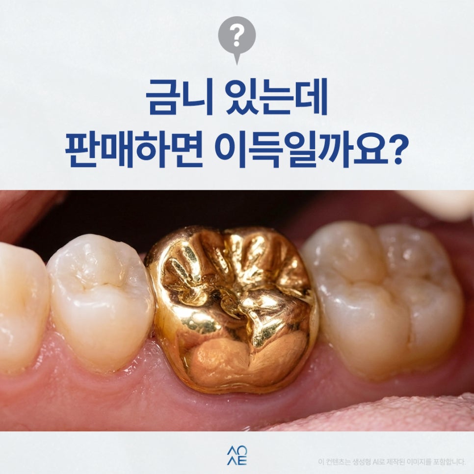 금니 판매 시세 금액 얼마나 이득볼까? 치료비도 계산해 본다면 관련 이미지 1