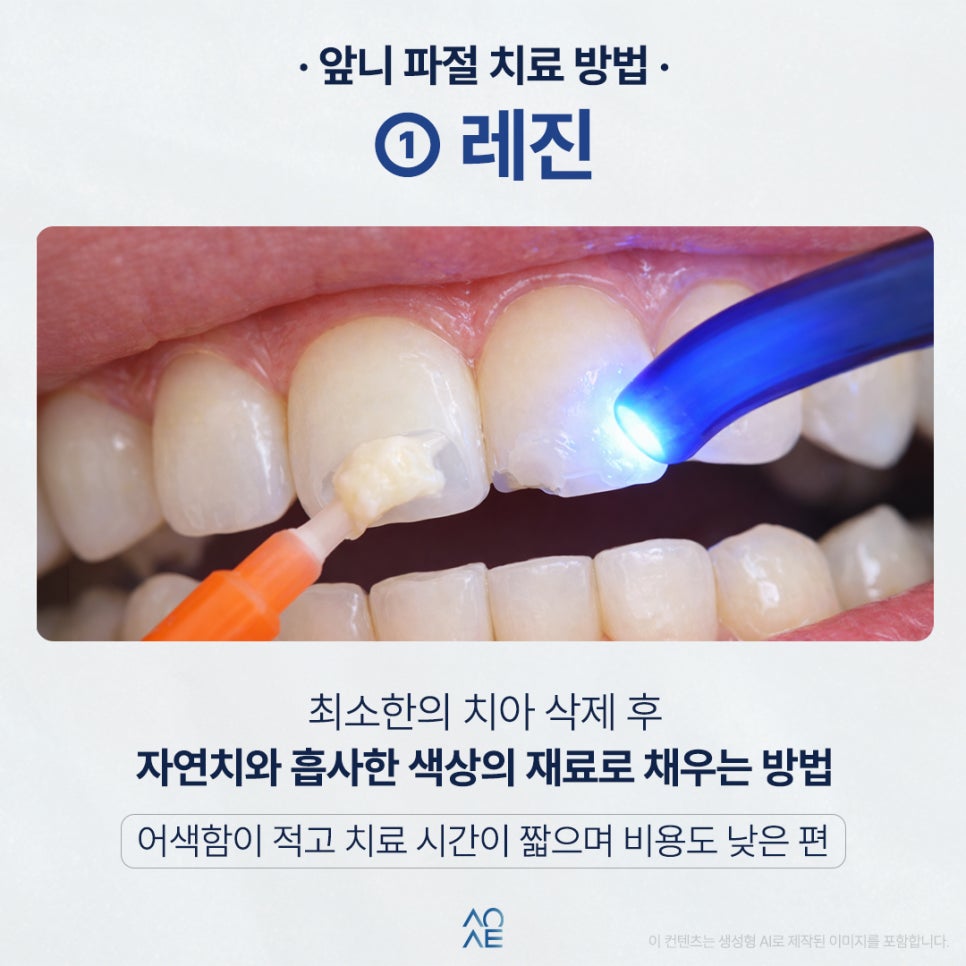 3 Treatment Options and a Cost Comparison for a Chipped Front Tooth image 3