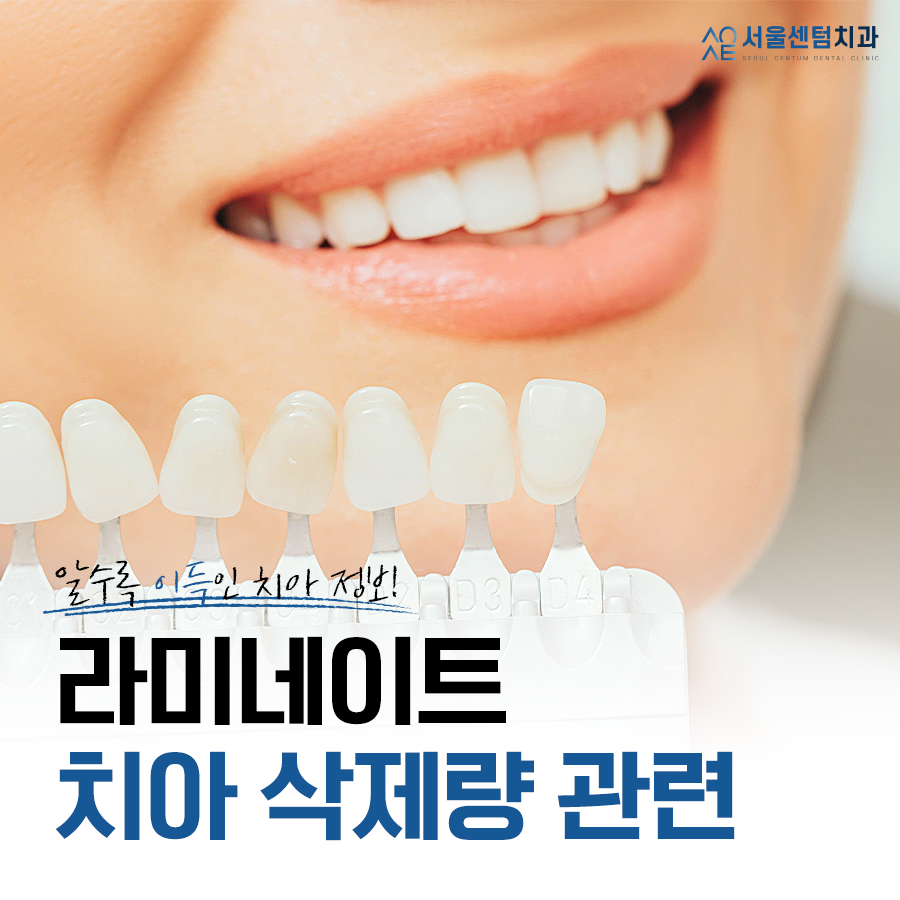 라미네이트 치아삭제량 관련 유익한 정보 관련 이미지 1