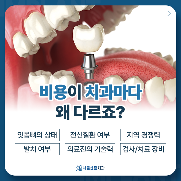 전체임플란트 비용 기준 삼는 사항을 바탕으로 결정된다? 관련 이미지 3