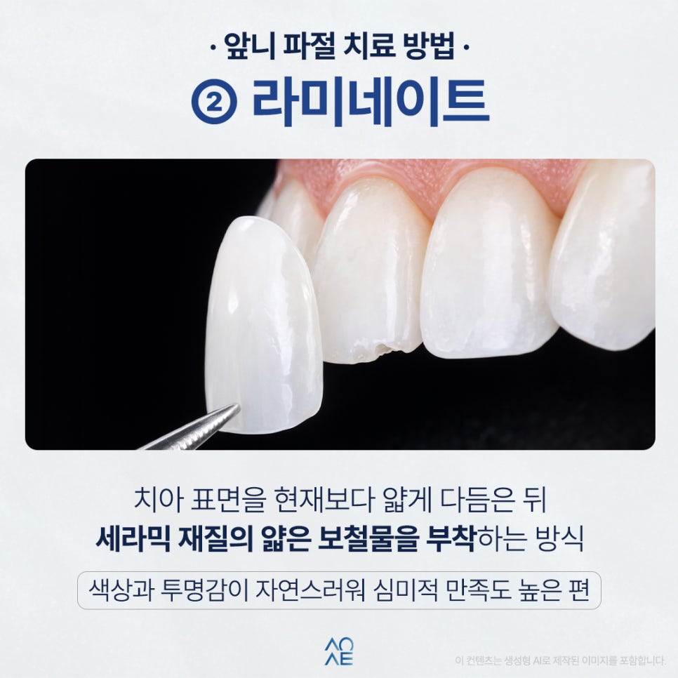 3 Treatment Options and a Cost Comparison for a Chipped Front Tooth image 4