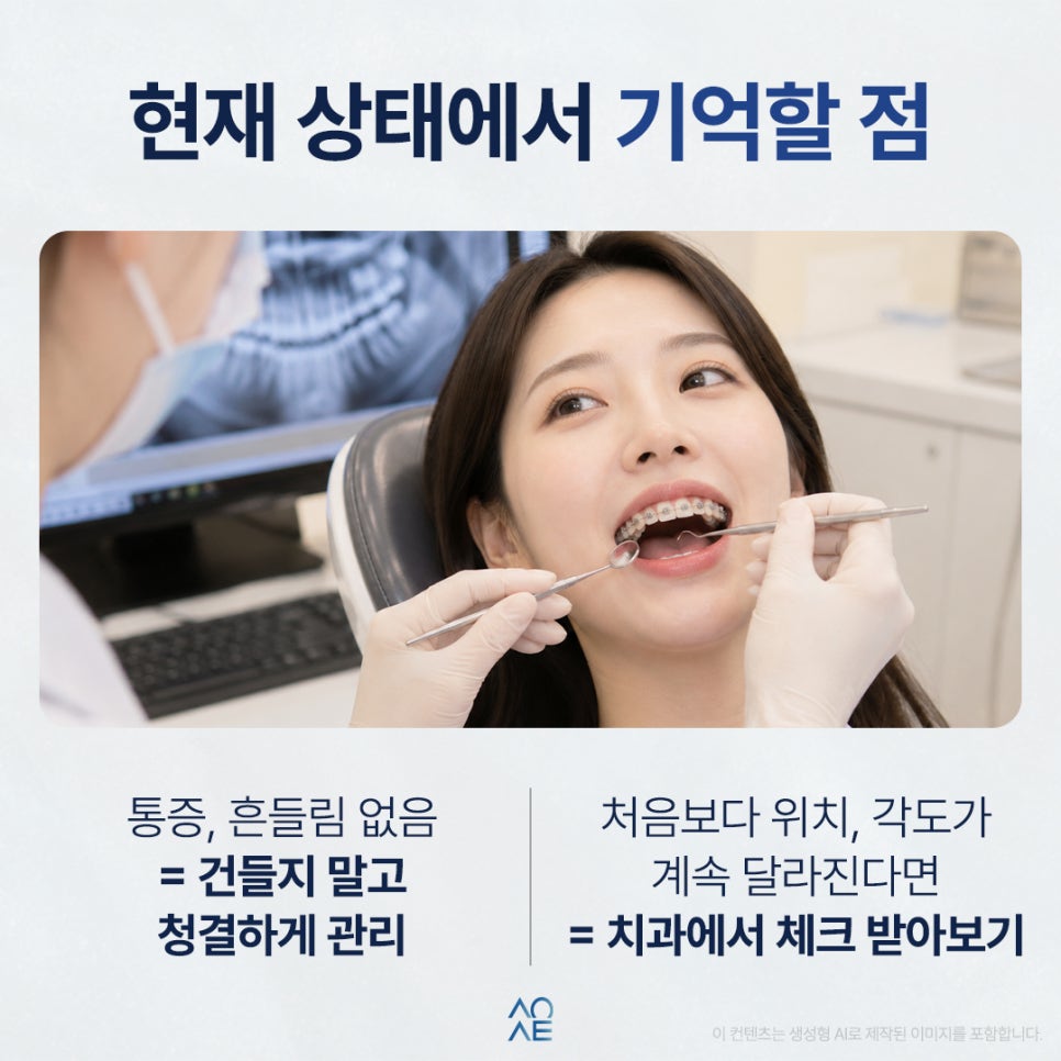교정 미니스크류 풀리는 것 같은데 그대로 내버려둬도 되나요? 관련 이미지 7