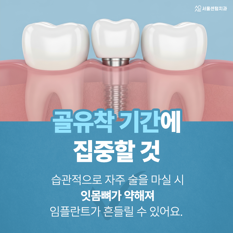 임플란트 음주 식립 당일 며칠 몇 주 후에 가능? 적절 시기 관련 이미지 6