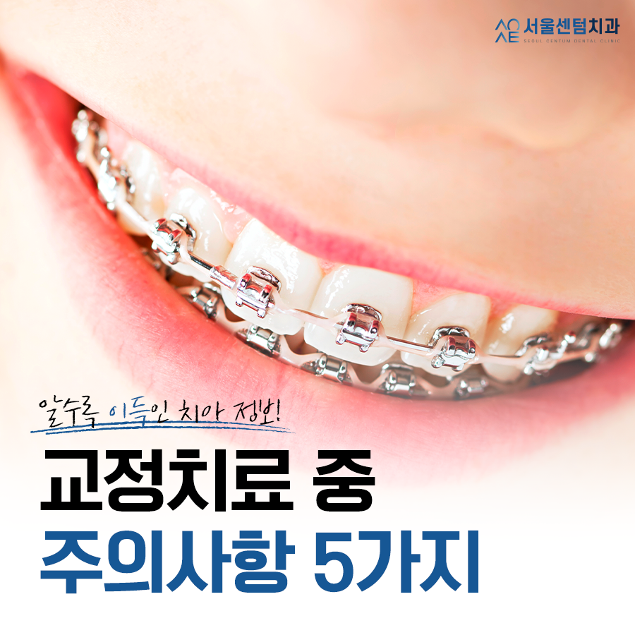교정치료 중 주의사항 기억해두고 실천하면 좋아요 관련 이미지 13