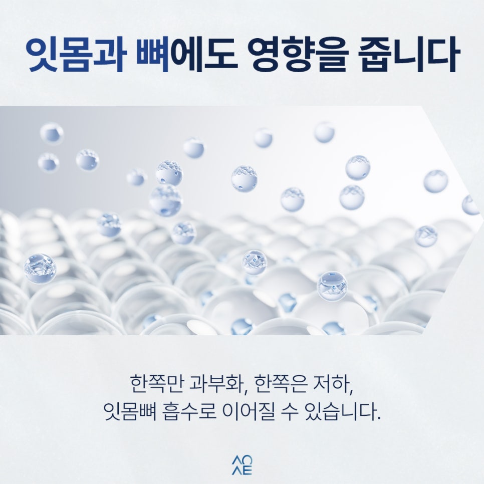 한쪽으로만 씹으면 생기는 일 나중에 임플란트까지 갈 수 있습니다 관련 이미지 4