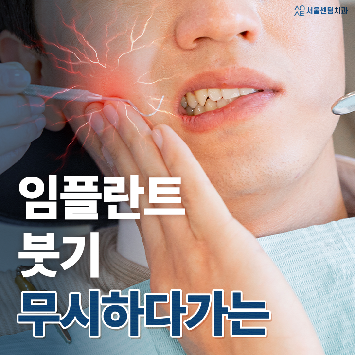 임플란트의 붓기 통증 잇몸에서 시작되는 신호일 수 있습니다 관련 이미지 1