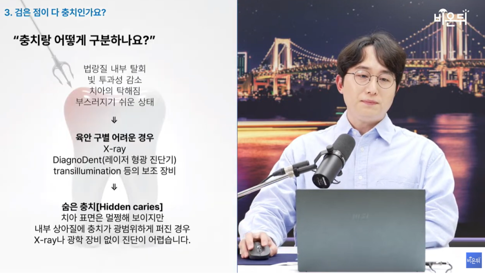 의학채널 비온뒤 유튜브 채널 첫출연 충치 아프면 늦습니다 충치치료법 관련 이미지 16