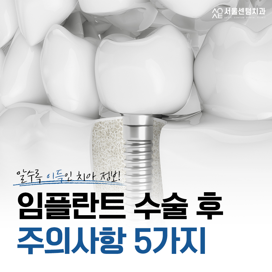 임플란트 수술 후 주의사항 5가지 어떤 게 속할까? 관련 이미지 2