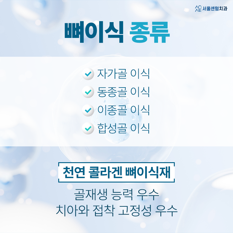 임플란트뼈이식통증 과정 필요성 관련 이미지 4